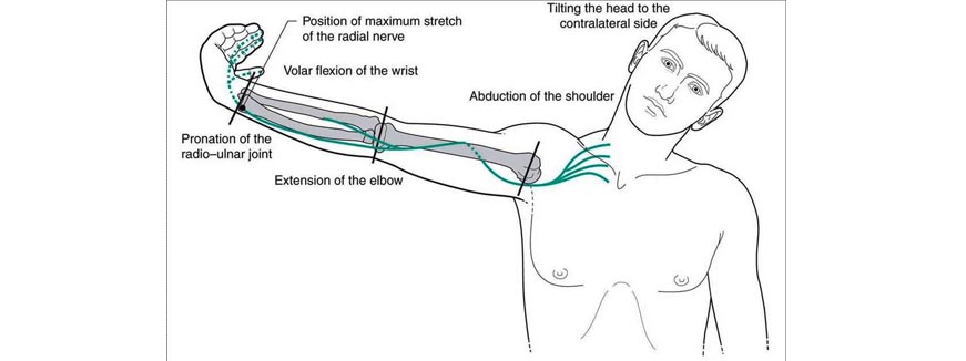 Neurodynamics - Karur Physiotherapy